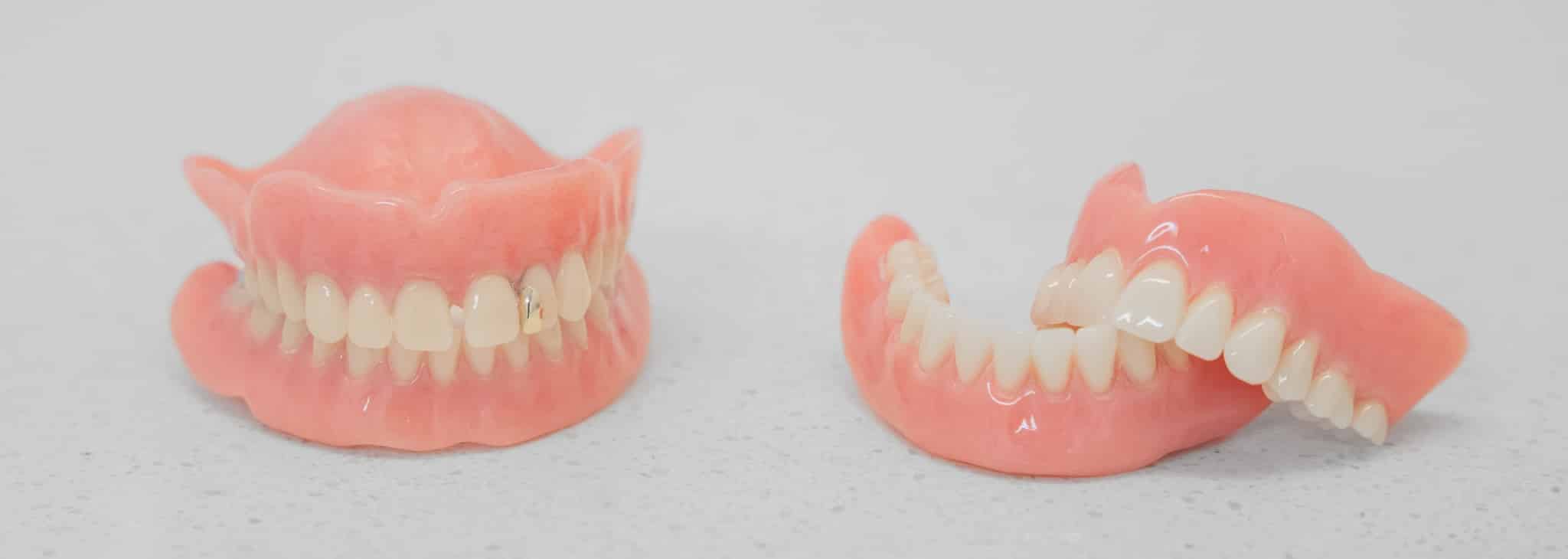 Full Upper And Lower Dentures
